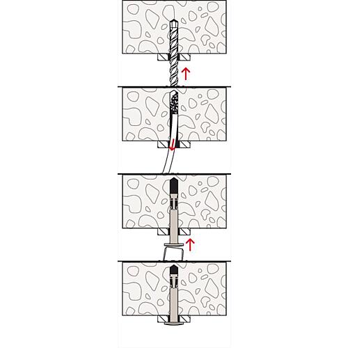 Nail anchor FNA II with nail head Anwendung 3